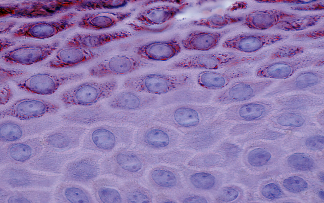 Why and How Do We Study Keratinocytes?