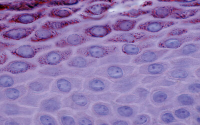 Why and How Do We Study Keratinocytes?